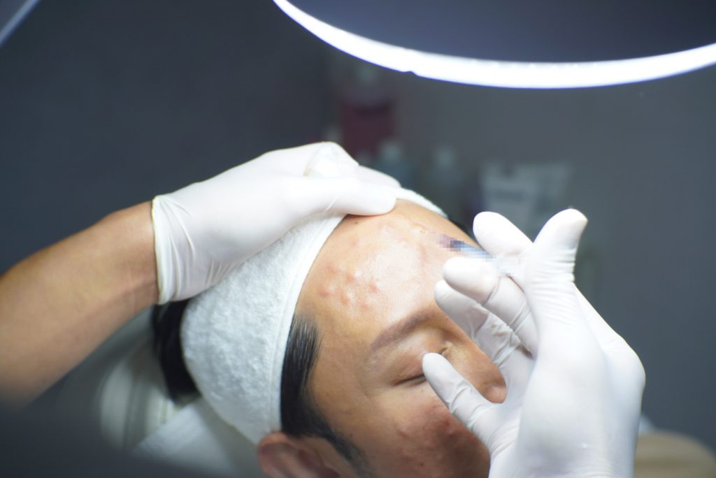 รีวิวโปรแกรม Skin Booster