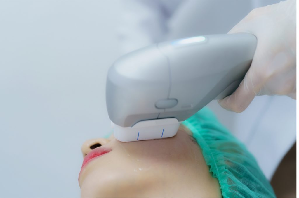 Ultra HIFU at Akira Clinic