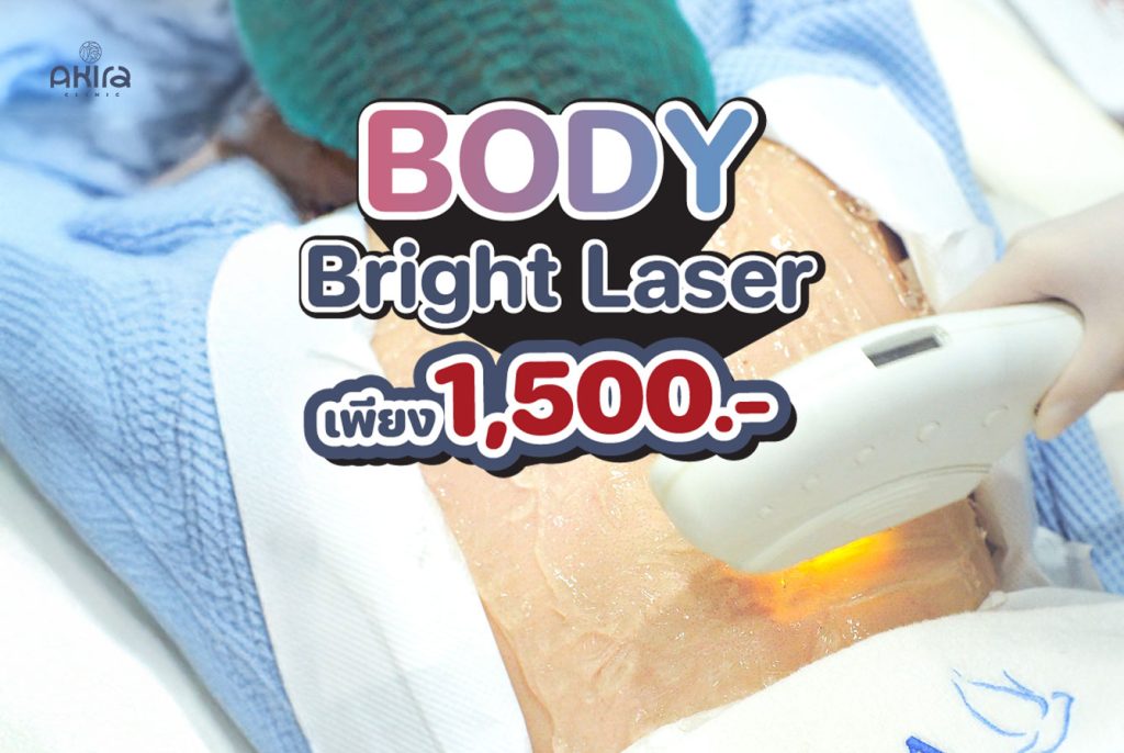 มะนาว รีวิว Body Laser + Mask