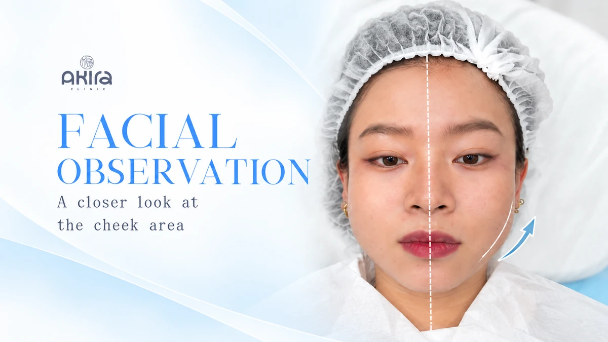 AI-assisted illustration of the cheek area